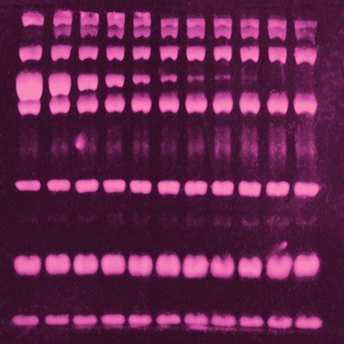 SYPRO Ruby Protein Gel Farbstoff